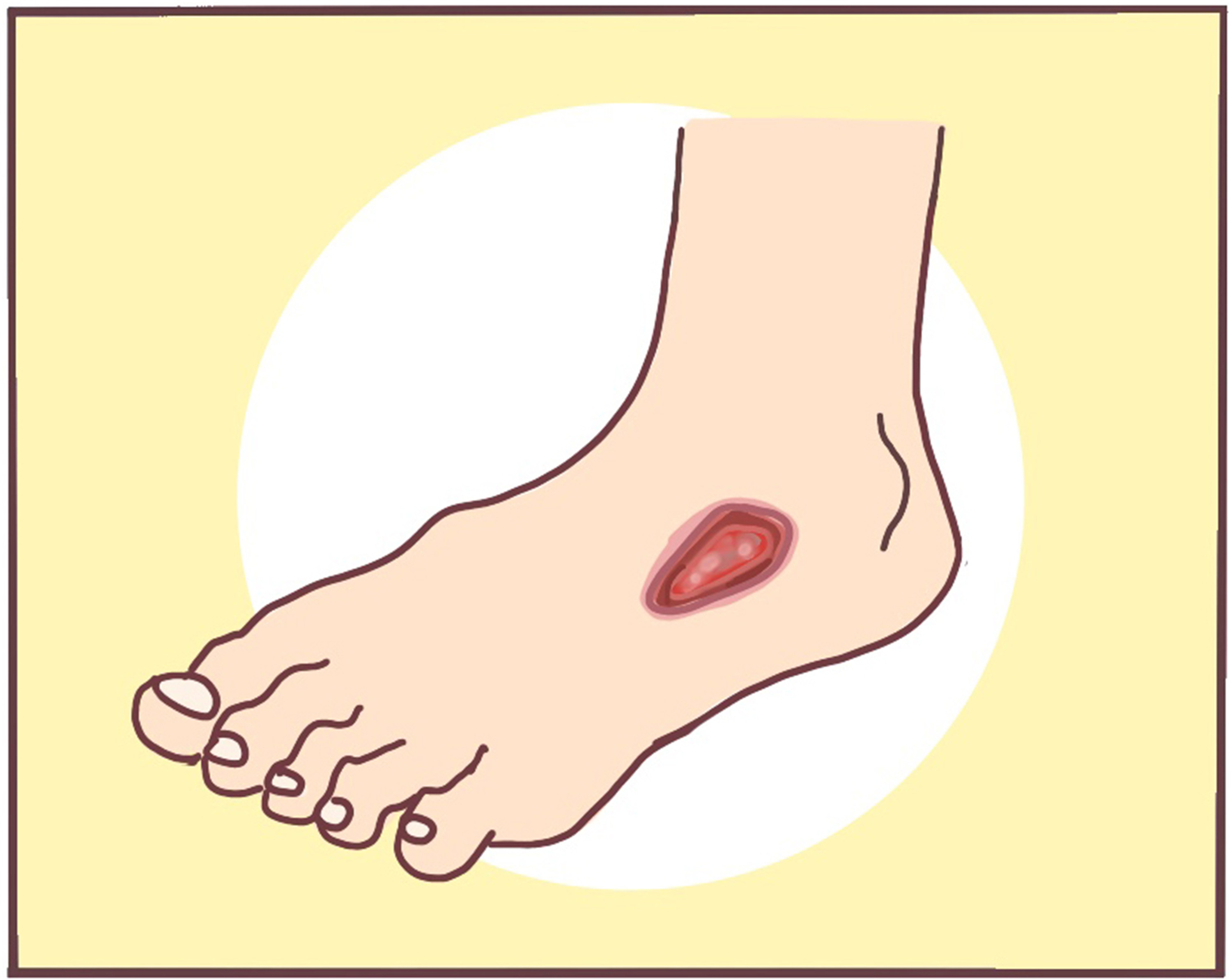 杨天真切胃真的可以治疗糖尿病吗,杨天真糖尿病