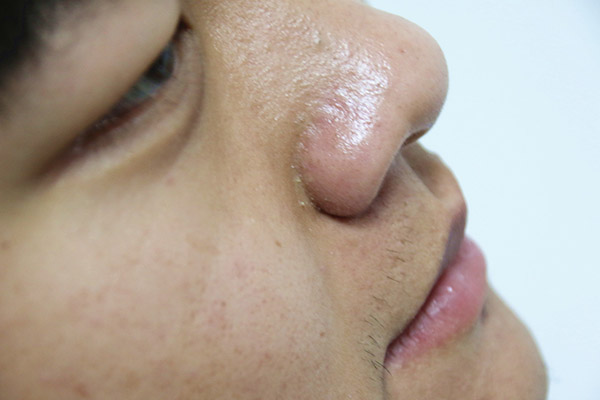 为什么一晒就黑有的人就晒不黑,为什么有些人一晒就黑