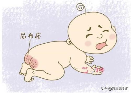 小孩皮炎红屁股，涂点山茶油就好