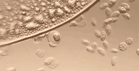 *处私**湿痒难忍,异味大吓跑老公!炎夏必备