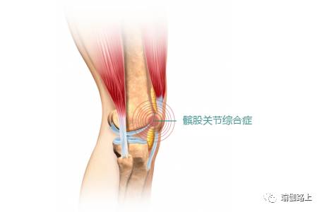 5种缓解膝盖疼痛的瑜伽疗法,练瑜伽膝盖里侧疼如何矫正