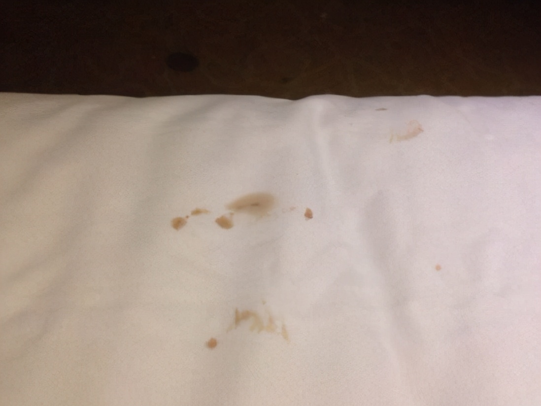 床单染了血迹,床单染了染料怎么能洗掉