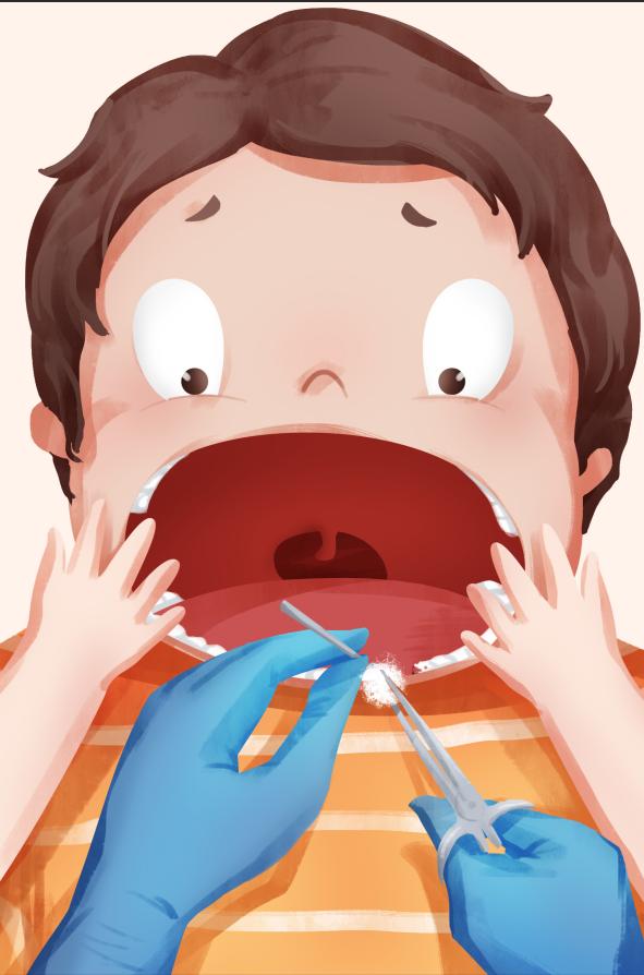 原来拔智齿也有最佳年龄,拔智齿的最佳年龄不要错过