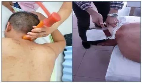 颈椎病三招搞定,几招搞定颈椎病