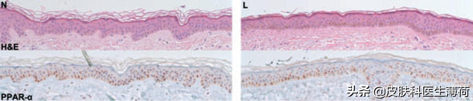 黄脸婆吃什么祛斑,告别黄脸婆自制纯中药祛斑面膜