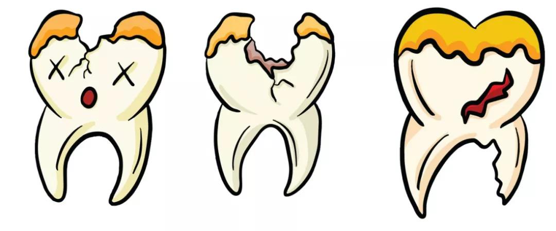 牙齿烂了只剩下牙冠要拔掉吗,半截牙齿是否拔掉