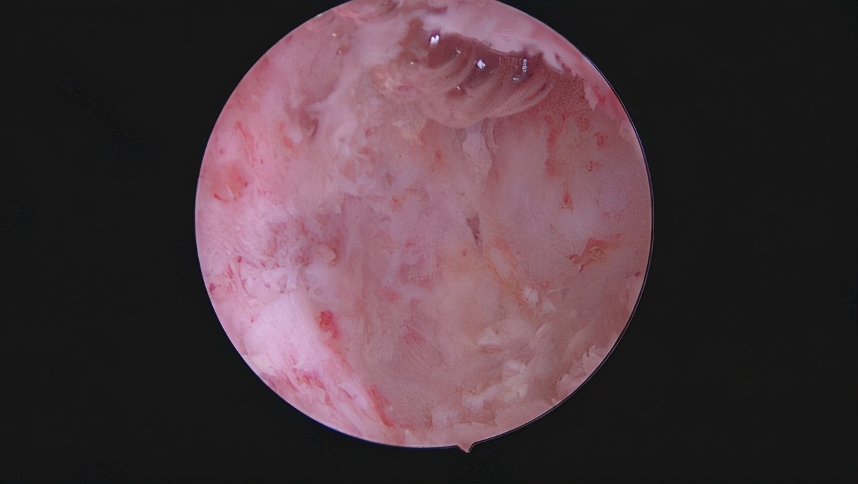 安徽宫腔镜手术专家排名,安徽省立宫腔镜哪个医生做的好