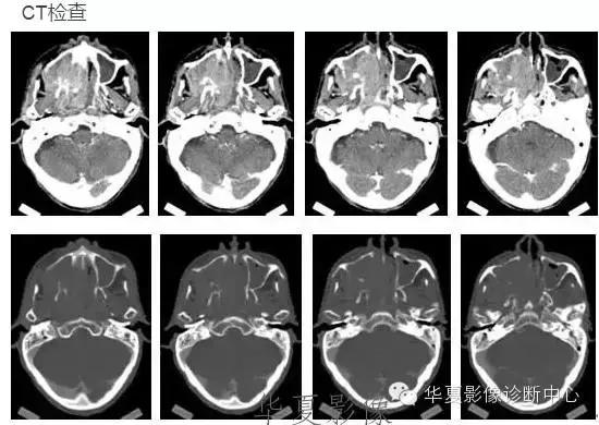 这些部位的黑色素瘤，您会诊断吗？