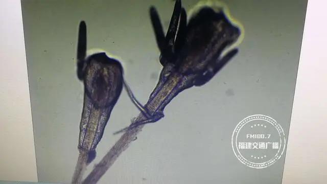 福州一女子狂掉眉毛,一查竟发现是螨虫作祟!医生:要选择正规的医疗机构做项目