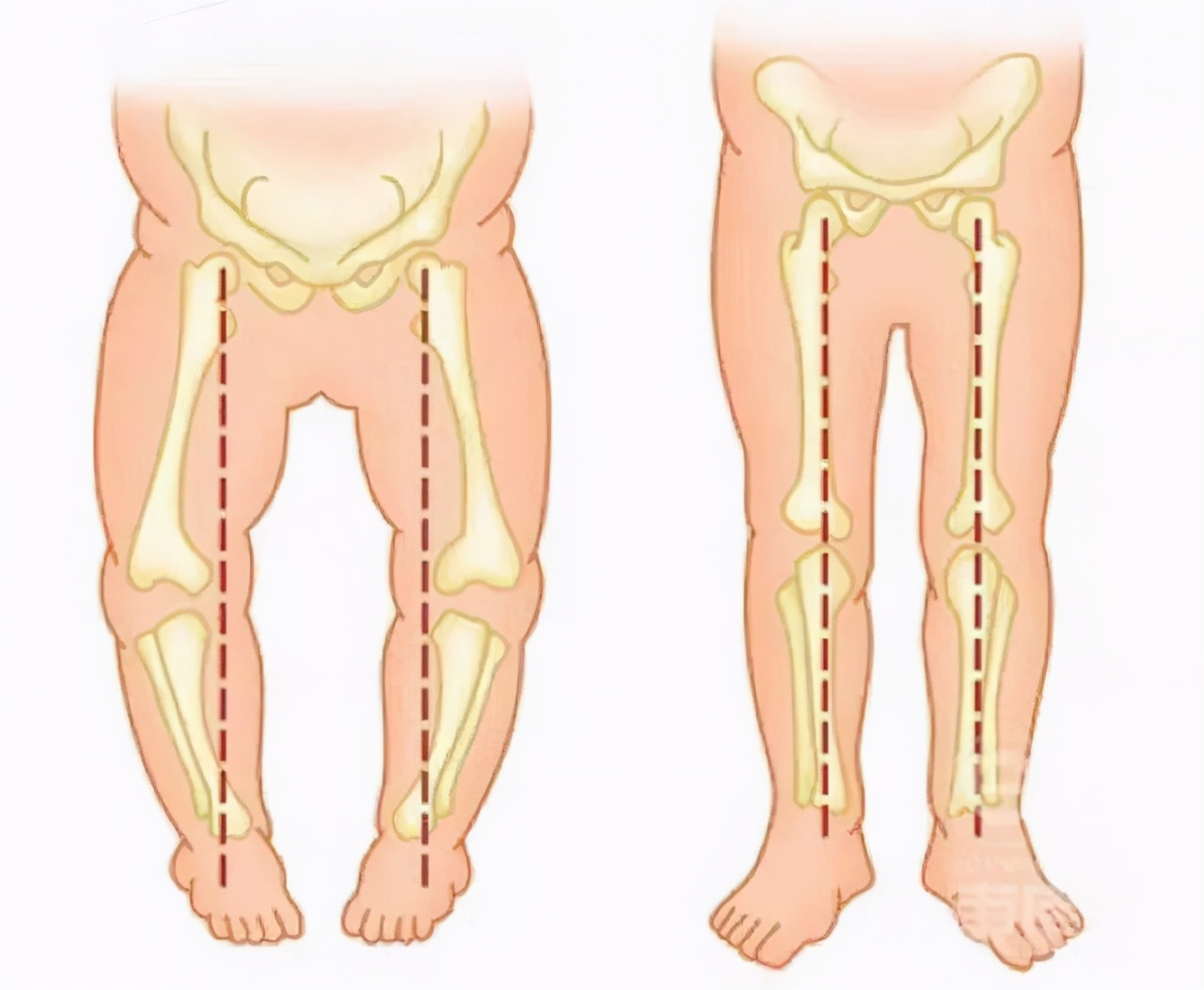 胯宽是因为腿短,腿粗胯宽腿型不直