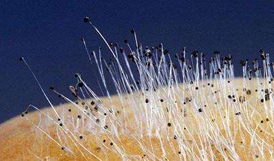 霉菌是什么病图片,霉菌是啥