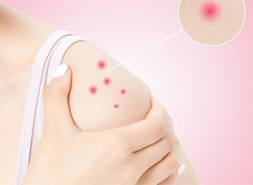 冬季皮肤瘙痒一抓就起疙瘩,老人冬季皮肤瘙痒怎么解决