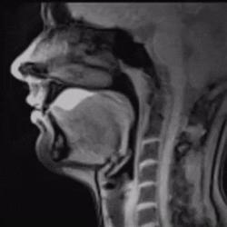 知常识|如果人嘴里没有唾液会怎样？