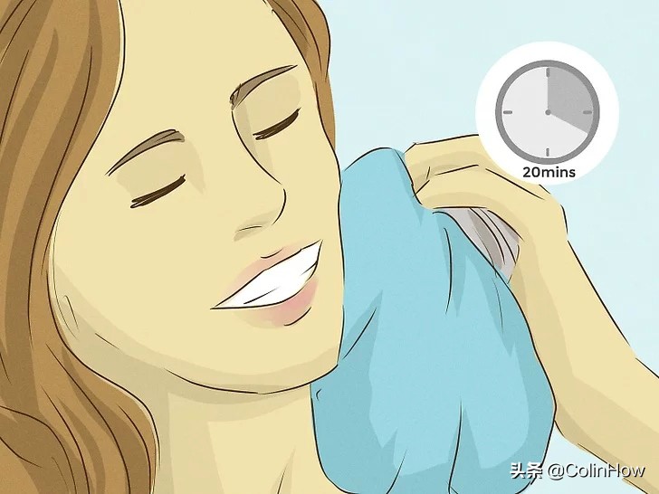 如何去除吻痕,怎么遮盖吻痕