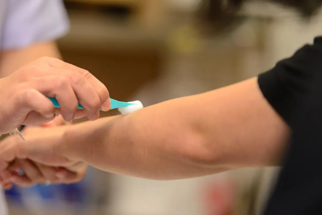 往伤口上撒盐撒辣椒粉,在伤口上撒盐有多疼