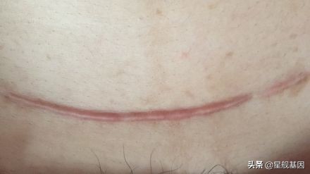 产后妈妈十大疼痛,哪一个你中招了?