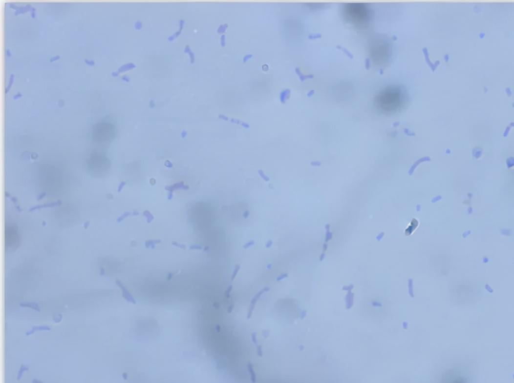 黄骨鱼出血病下什么药,黄骨鱼内脏出血是怎么回事