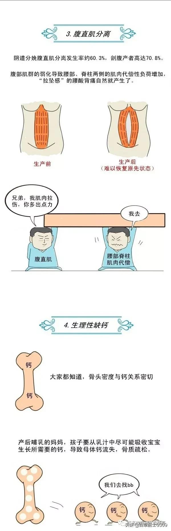 产后腰背痛的原因、治疗及康复