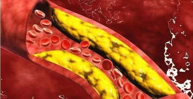 风湿病患者谈“激素”色变！正确认识糖皮质激素，助你早日康复