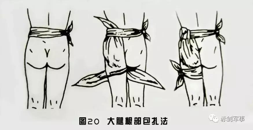 军队三角巾包扎法视频,部队卫生与救护三角巾包扎方法