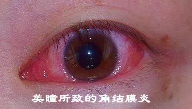 有哪些保护眼睛的小妙招100字,眼科医生推荐怎么保护眼睛