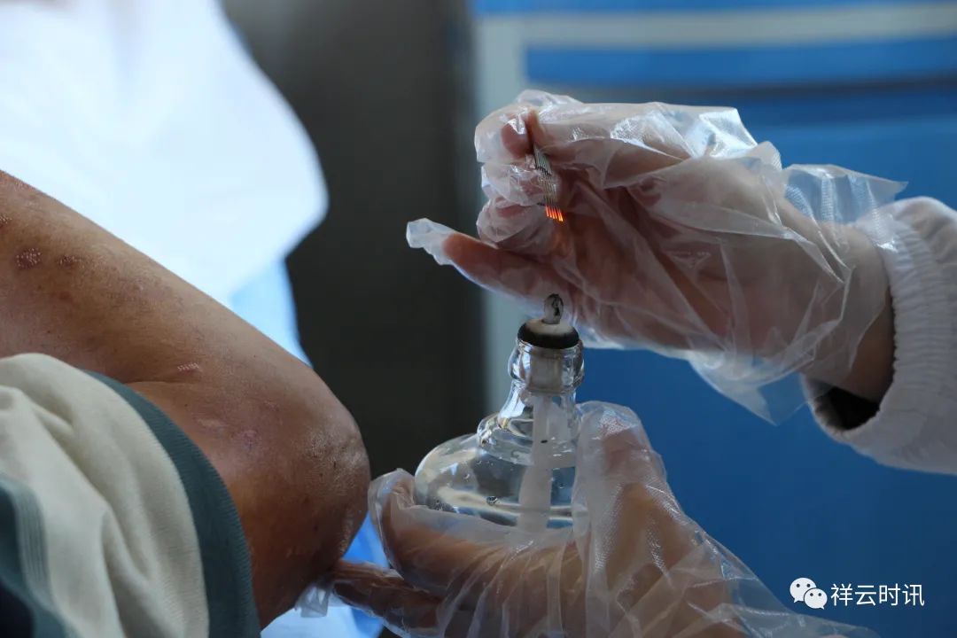 火针疗法的传承人在哪里,南京中医火针疗法