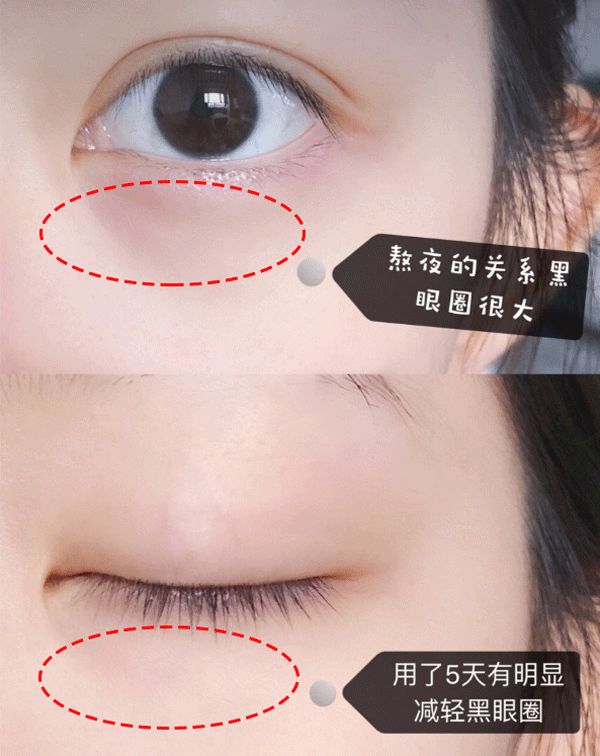 韩国大牌眼霜,吴昕爱马仕眼霜怎么样