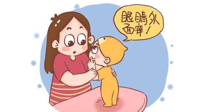 宝宝老是眨眼睛怎么解决,宝宝老眨眼睛怎么回事眼睛血丝多