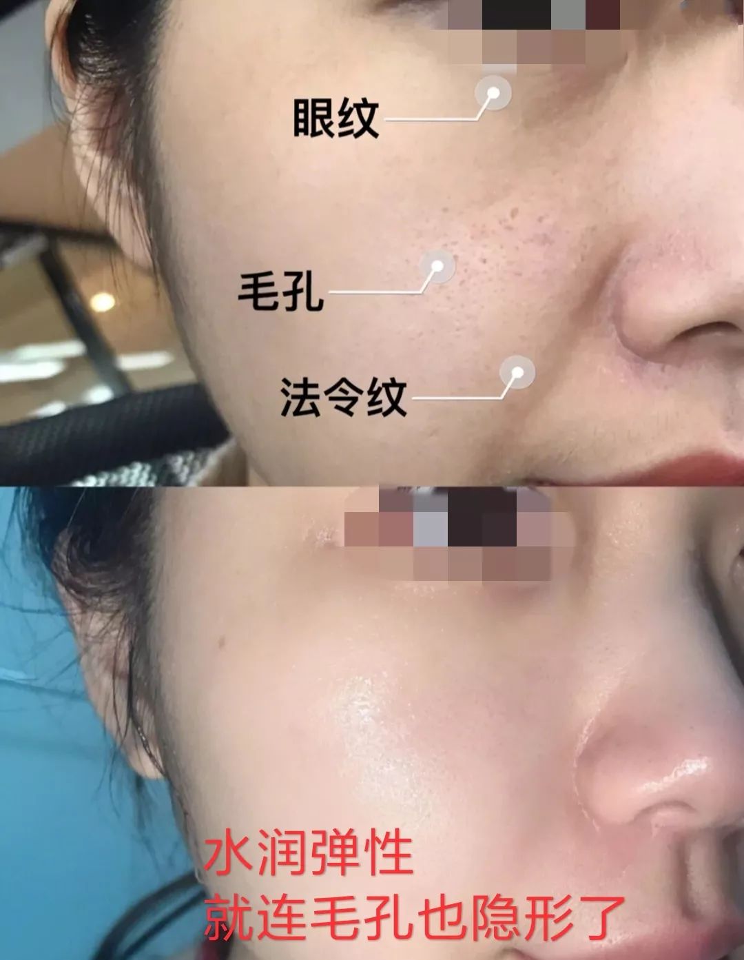 45岁金喜善素颜,金喜善冻龄秘密