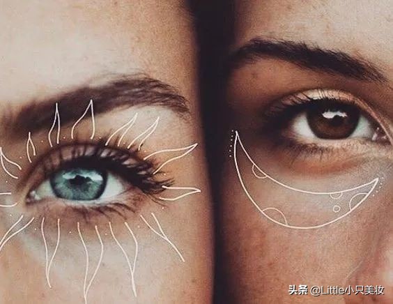 去眼纹打肉毒素吗,去眼纹打多少肉毒素合适