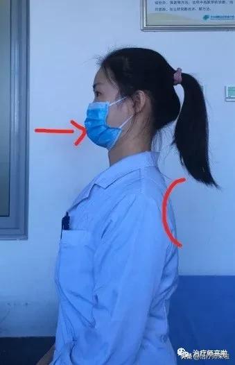 上交叉综合征怎么放松,上交叉综合征能治好需要多少钱