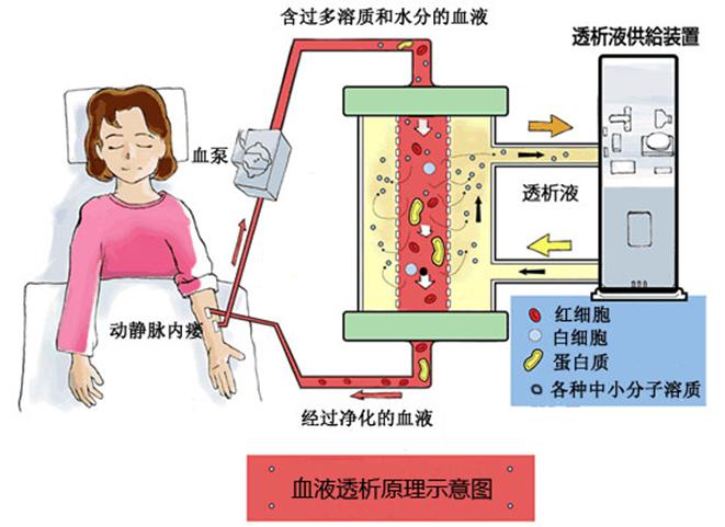 透析前检查什么,透析看什么指标