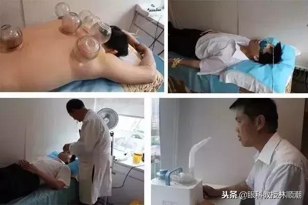 眼干针灸穴位,干眼针灸