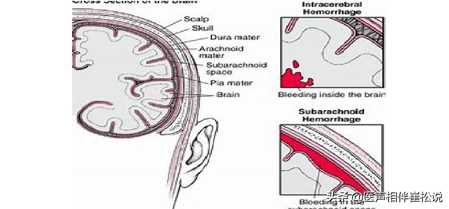 做好这几件事有助于康复,做好这四件事远离危险