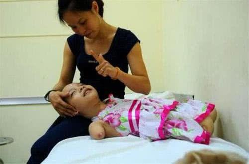 怀孕发现孩子没有手脚,怀孕七个月发现孩子没有手指