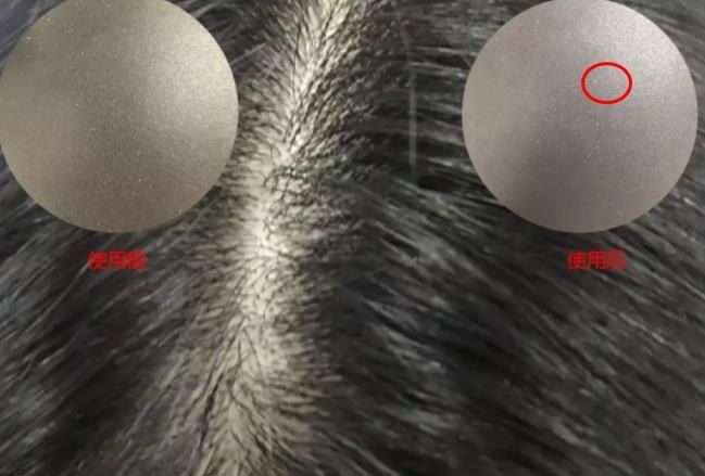 去屑洗发水深度测评六神,去屑止痒洗发水真实测评头屑多