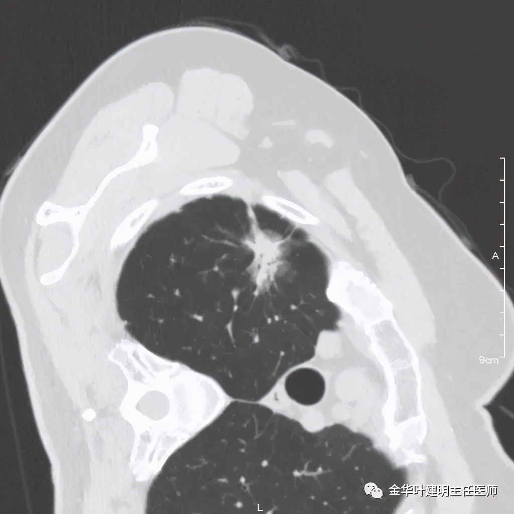 放个大招完整版教学,放个大招完整版前奏