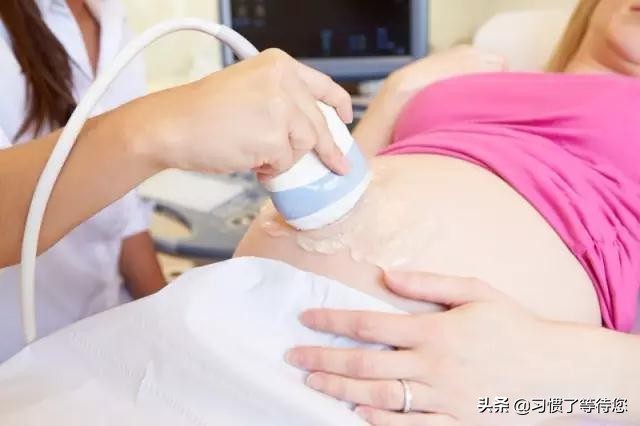 产检说是畸形儿宝妈坚持生下来,怀孕34周畸形儿的概率大吗