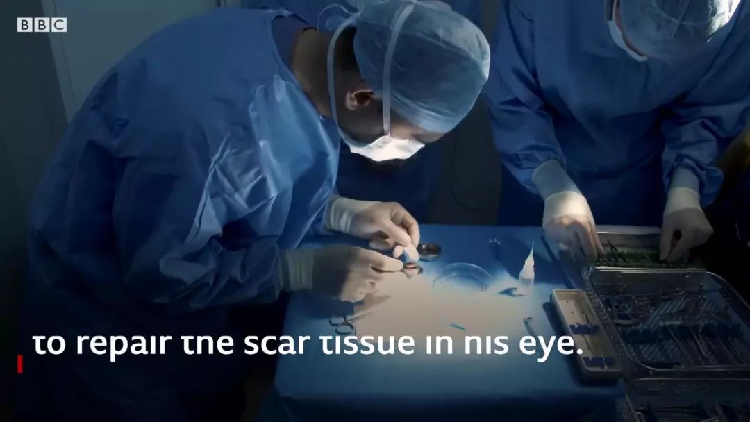 全球超过22亿人视力受损，干细胞疗法逆转过去无法治愈的失明