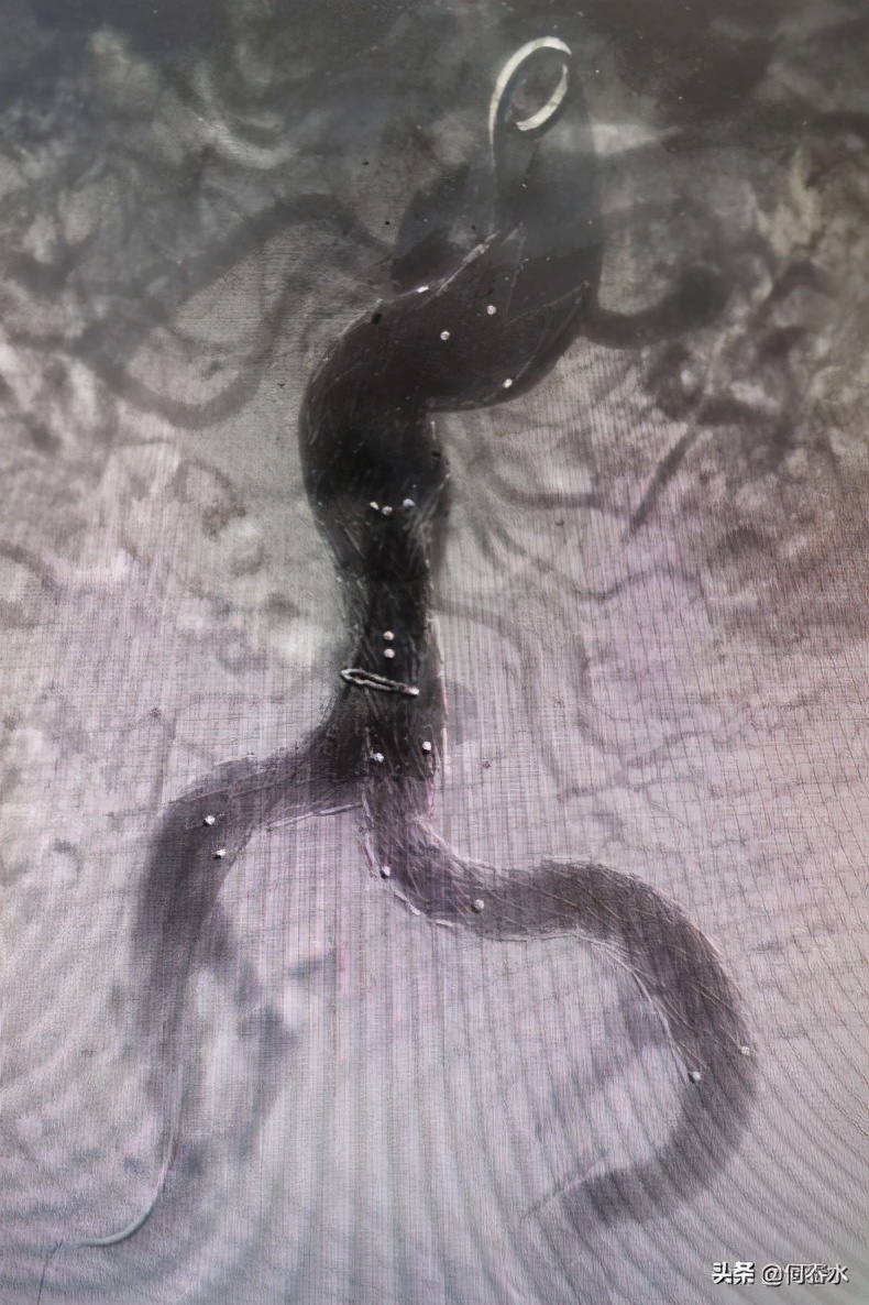 腹主动脉血管瘤需重视早期干预,医院成功救治主动脉夹层患者