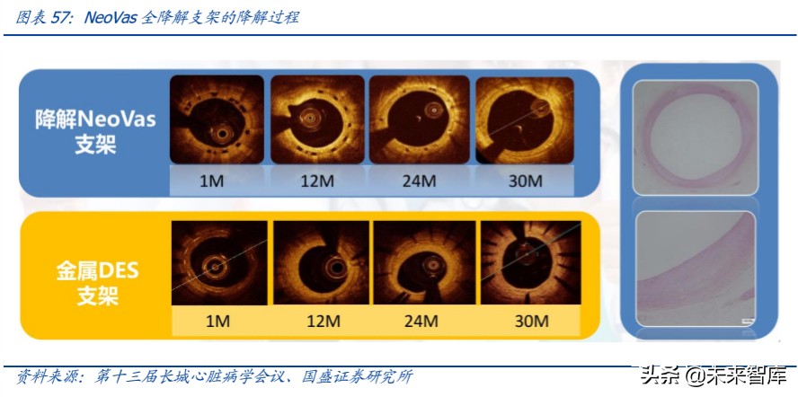 乐普医疗心血管专科医院,乐普医疗的战略