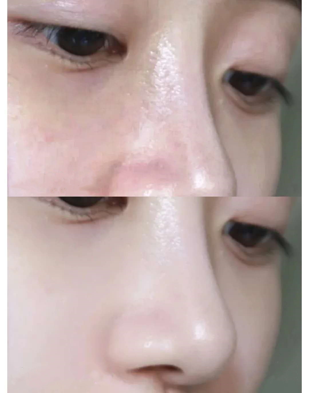 洗面奶选哪种才好,洗面奶不贵的能用吗