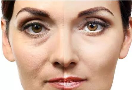 洗澡时搓下来的泥是什么?在显微镜下放大一百倍,看后让人不舒服