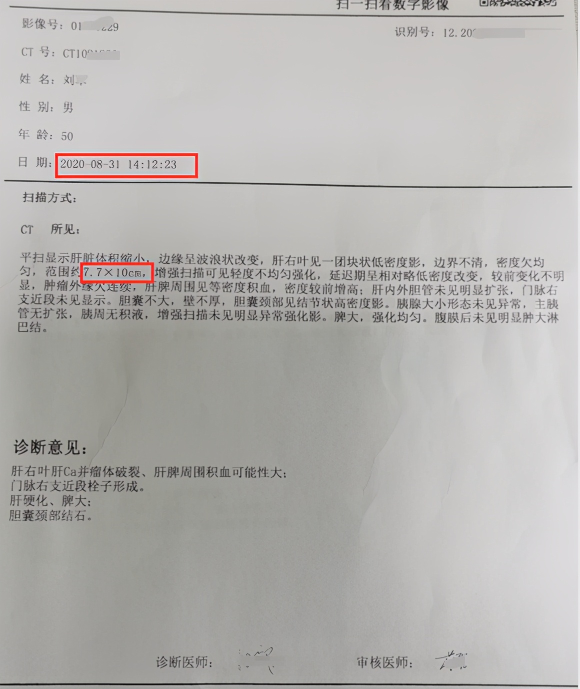 肝癌门静脉癌栓晚期大出血原因,肝癌肿瘤破裂出血手术成功率