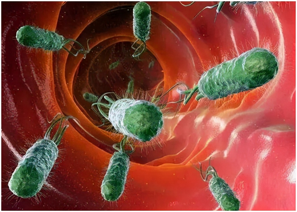 90%老便秘依赖泻药,年纪轻轻便秘就靠吃泻药了