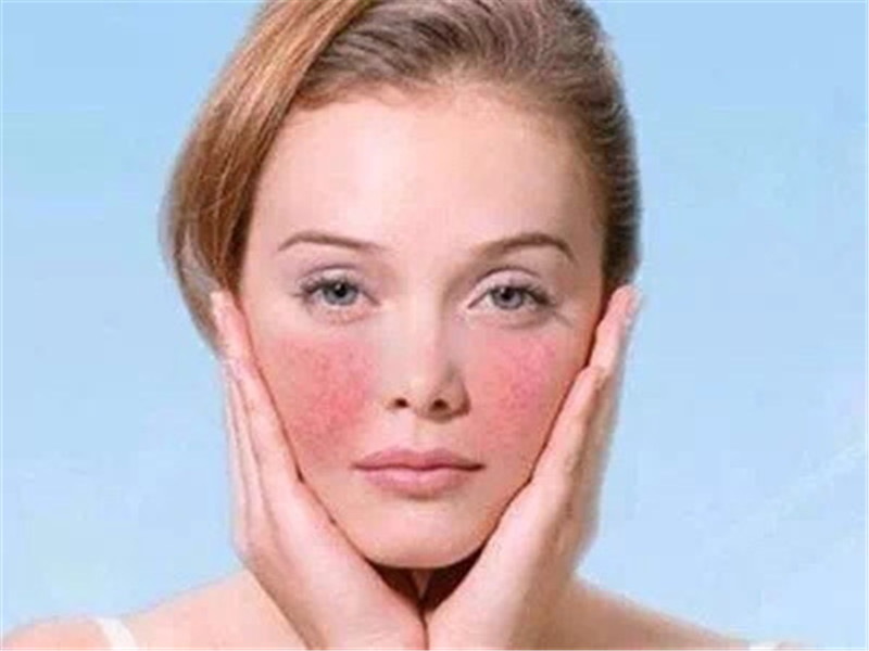 干痒肌肤怎么快速修复,换季皮肤干痒红如何护肤