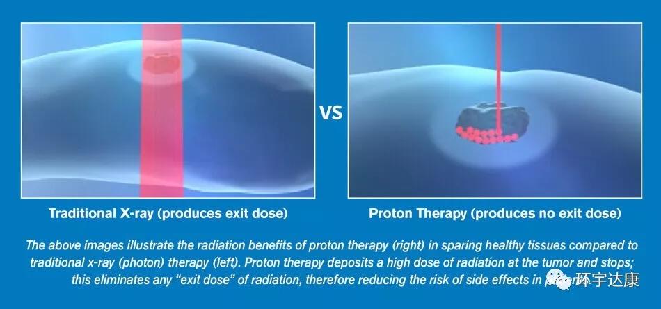 质子疗法已在中国崛起！这几类癌症患者最适合