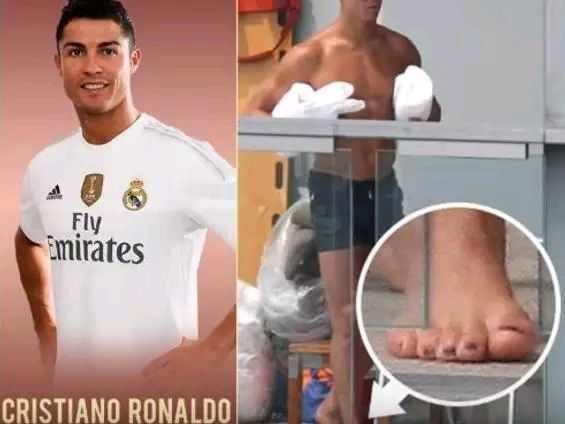 瞧瞧科比的手指，郑智的肚子，梅西C罗的脚，就会明白伟大不简单