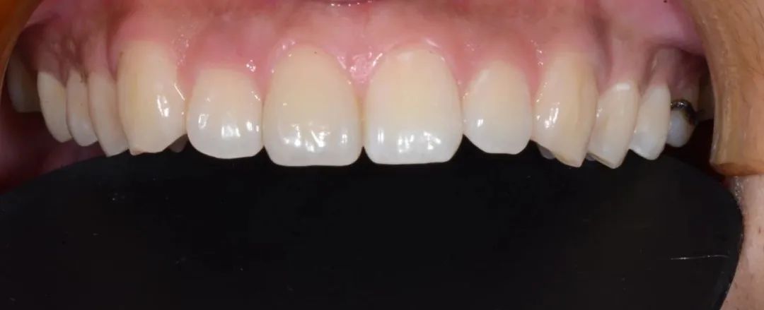 牙医从业感悟,牙医忠告11条