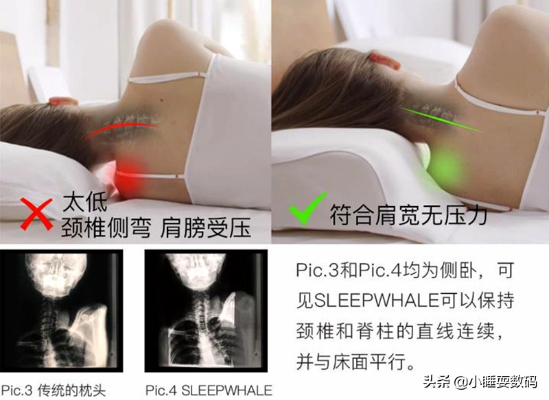 健康科普颈椎不好枕头应该怎么选,枕头选不好导致颈椎病
